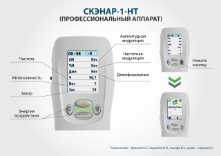 СКЭНАР-1-НТ (исполнение 01)  в Камышине купить Медицинская техника - denasosteo.ru 